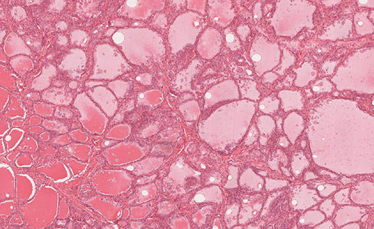 dabrielo-histologia